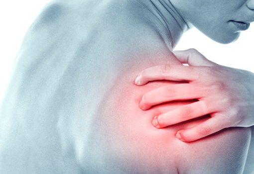 Bursite – bolsa inflamada – Causas, Sintomas, Tratamento e Cura