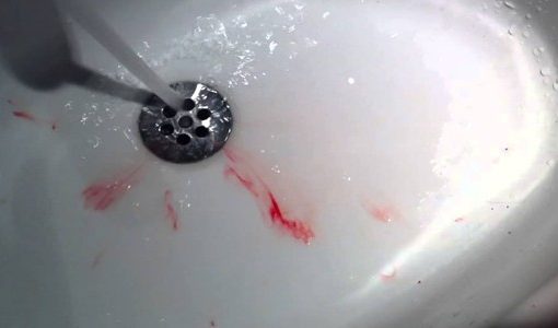 Cuspir sangue ao acordar – O que pode ser?