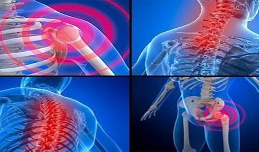 Nódulos Musculares – Sintomas, Causas e Tratamento